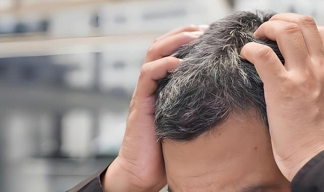 白发跟寿命有关？白发越少的人活得越久？解答来了